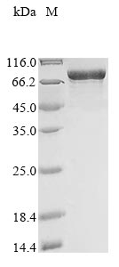 Recombinant Human Myosin-6 (MYH6), partial (160-816aa), N-terminal 10xHis-tagged, E.coli expression - 100 ug