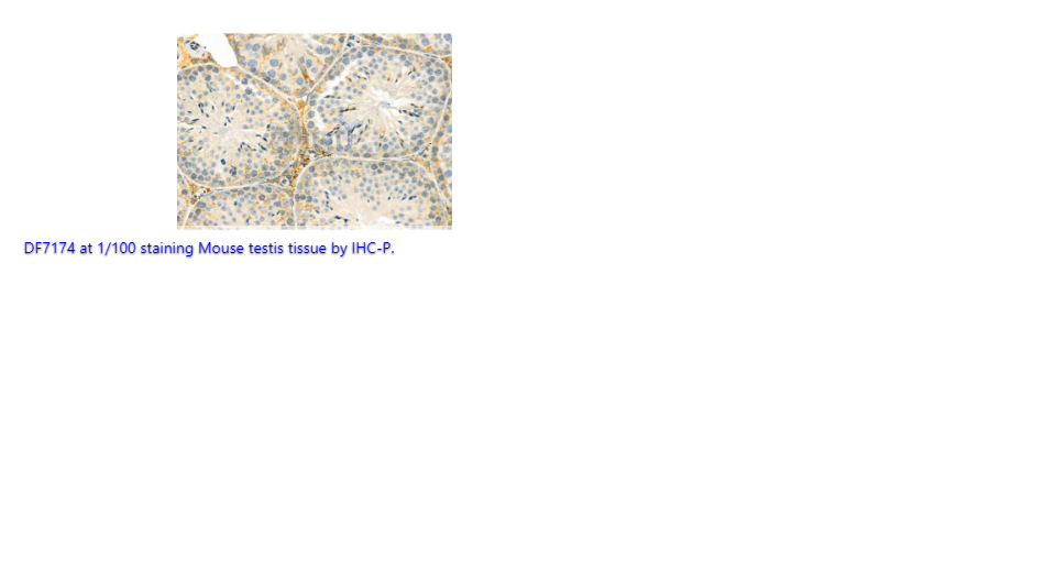 Peroxiredoxin 3 (PRDX3) polyclonal Antibody - 100 uL