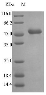 [0399-CSB-EP318584EZX-100UG] Recombinant Pseudomonas aeruginosa Elastase (lasB) - 100 ug